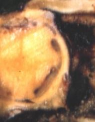 萎黄病の見分け方